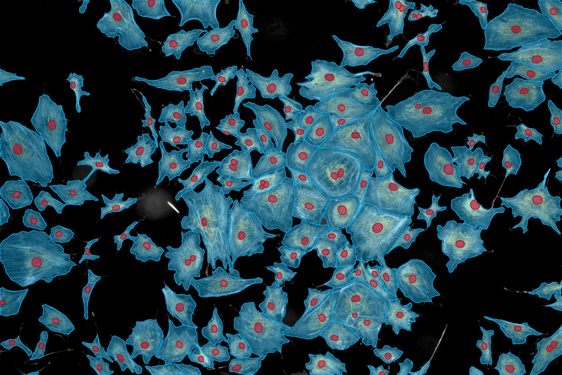 Improve Life Science Research Efficiency and Accuracy with AI and Automation for Accelerated Discoveries: AI Deep Learning