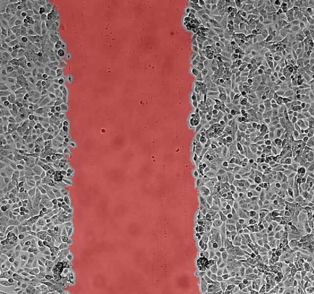 Wound Healing (Scratch Assay)