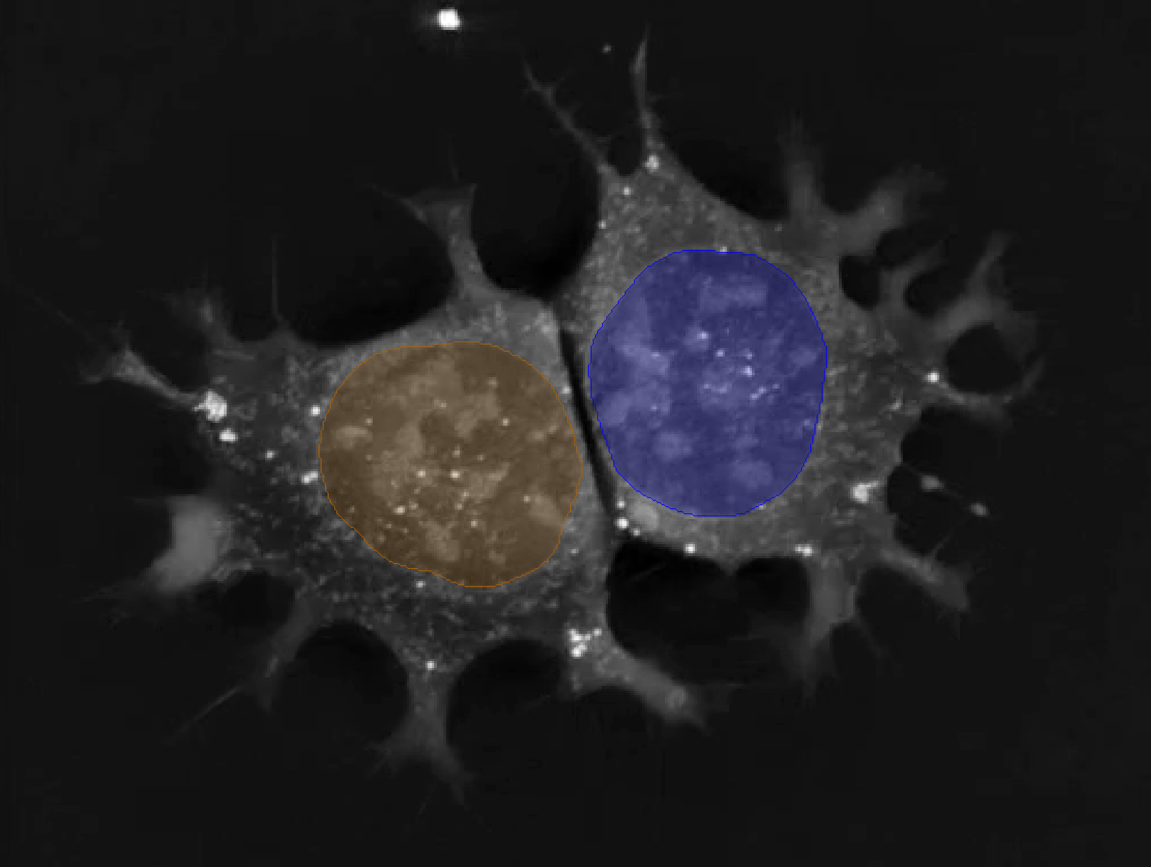 Holotomography Nuclei