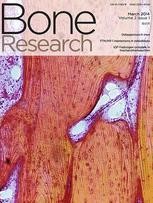 GnIH secreted by green light exposure, regulates bone mass through the activation of Gpr147