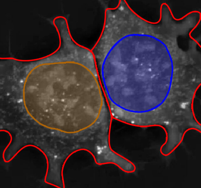 Cell Morphology (Holotomography)