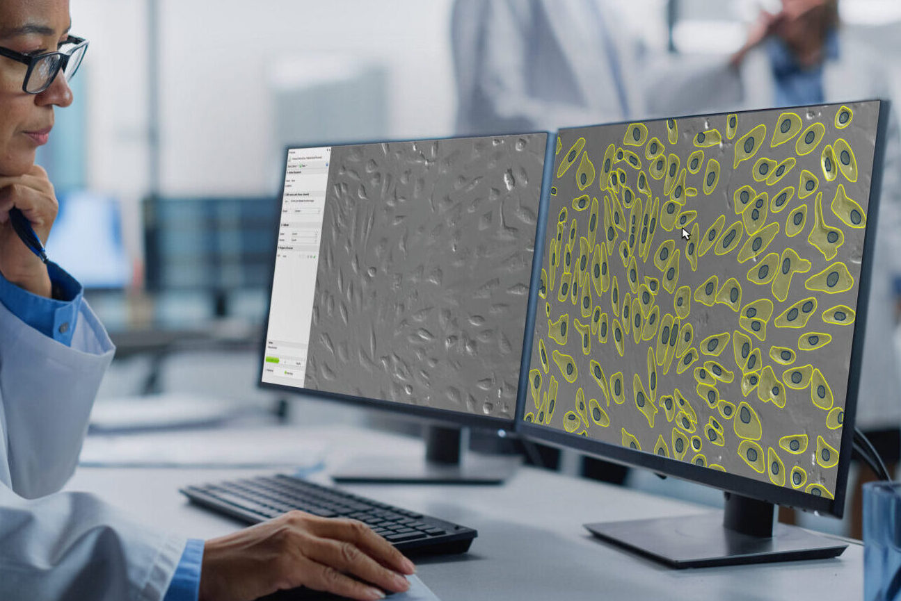 Image-Pro v11.0.4 is packed with a number of performance improvements to help you focus on the work that truly counts.