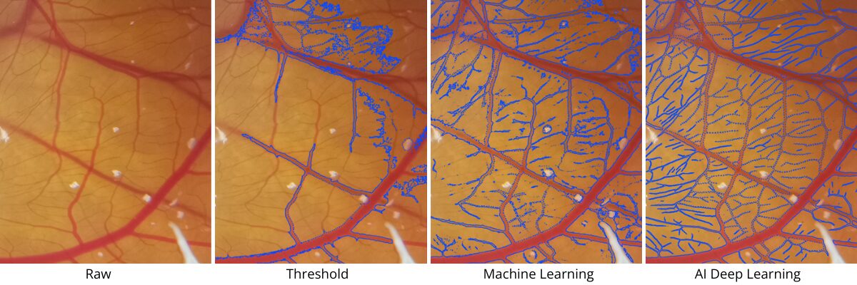 Core Segmentation Tasks Suited to AI