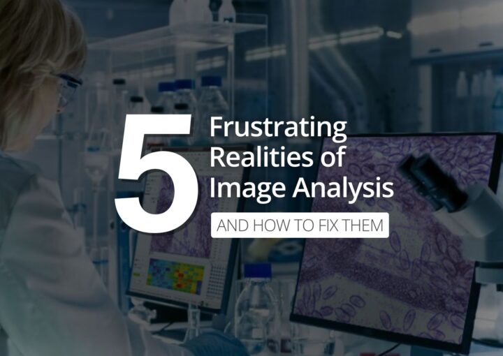 Five Frustrating Realities of Image Analysis (And How to Fix Them) Five Frustrating Realities of Image Analysis (And How to Fix Them)