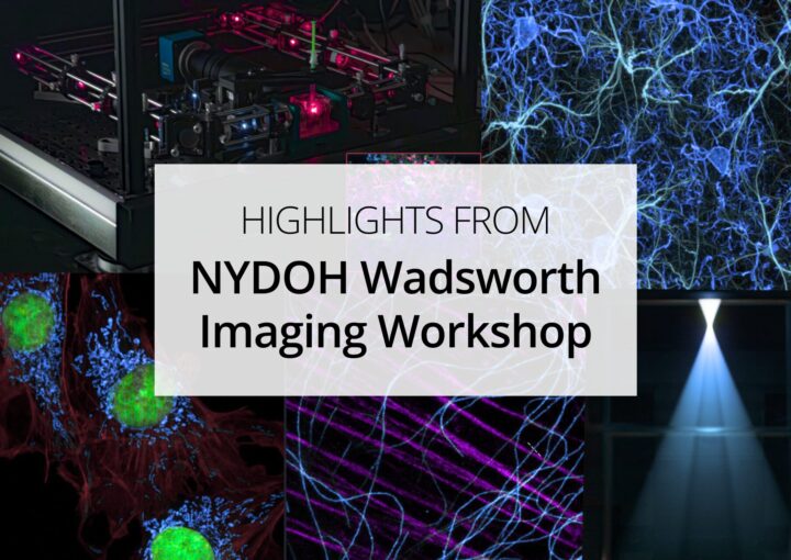 From Deconvolution to Deep Learning: Highlights from the NYSDOH’s Wadsworth Center Imaging Workshop From Deconvolution to Deep Learning: Highlights from the NYSDOH’s Wadsworth Center Imaging Workshop
