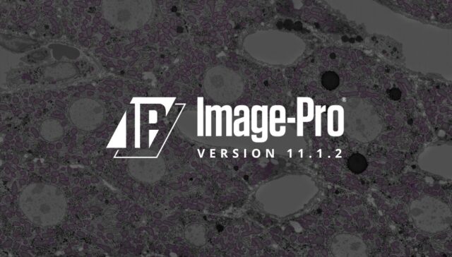 Discover What’s New in Image-Pro® 11.1.2! Discover What’s New in Image-Pro® 11.1.2!