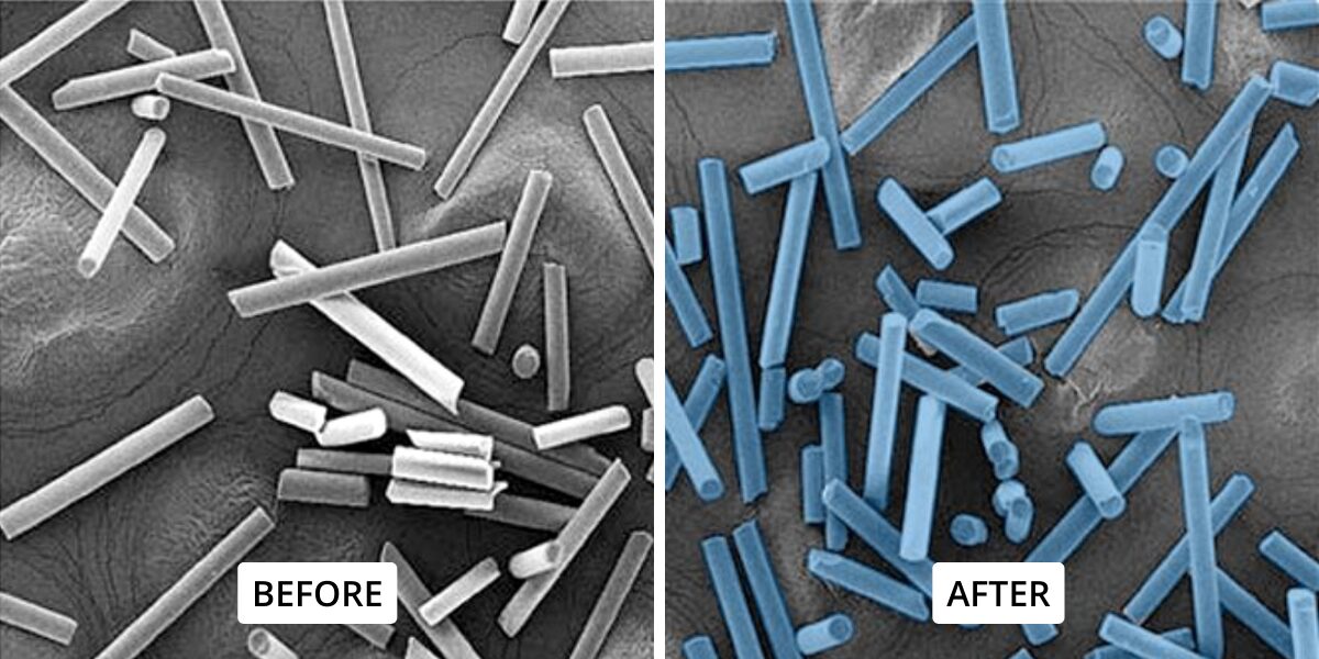 Semantic Segmentation in Microscopy: Pixel-Level Classification