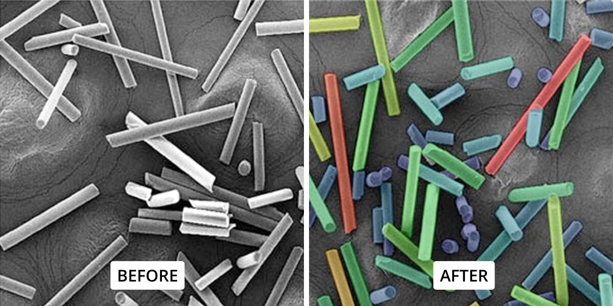Instance Segmentation in Microscopy (Cellpose, StarDist, & Beyond)