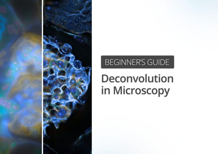 Deconvolution in Microscopy: Beginner’s Guide to Sharper, More Accurate Images Deconvolution in Microscopy: Beginner’s Guide to Sharper, More Accurate Images