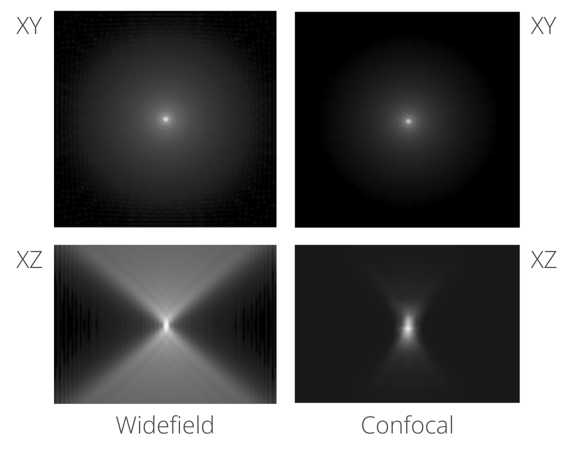 Deconvolution Methods in Microscopy: Fixed PSF and Iterative Approaches