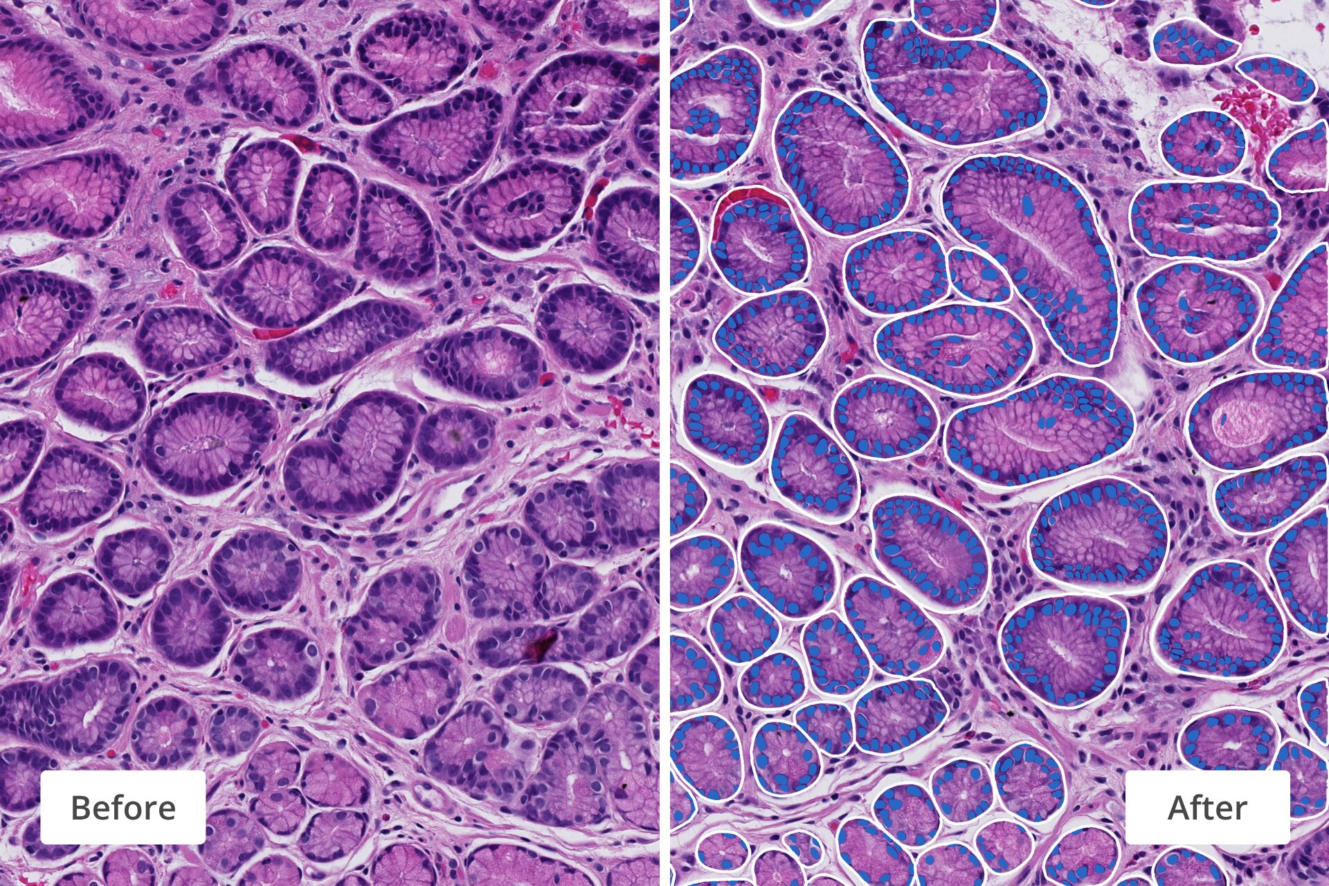 AI-Powered Accuracy You Can Trust