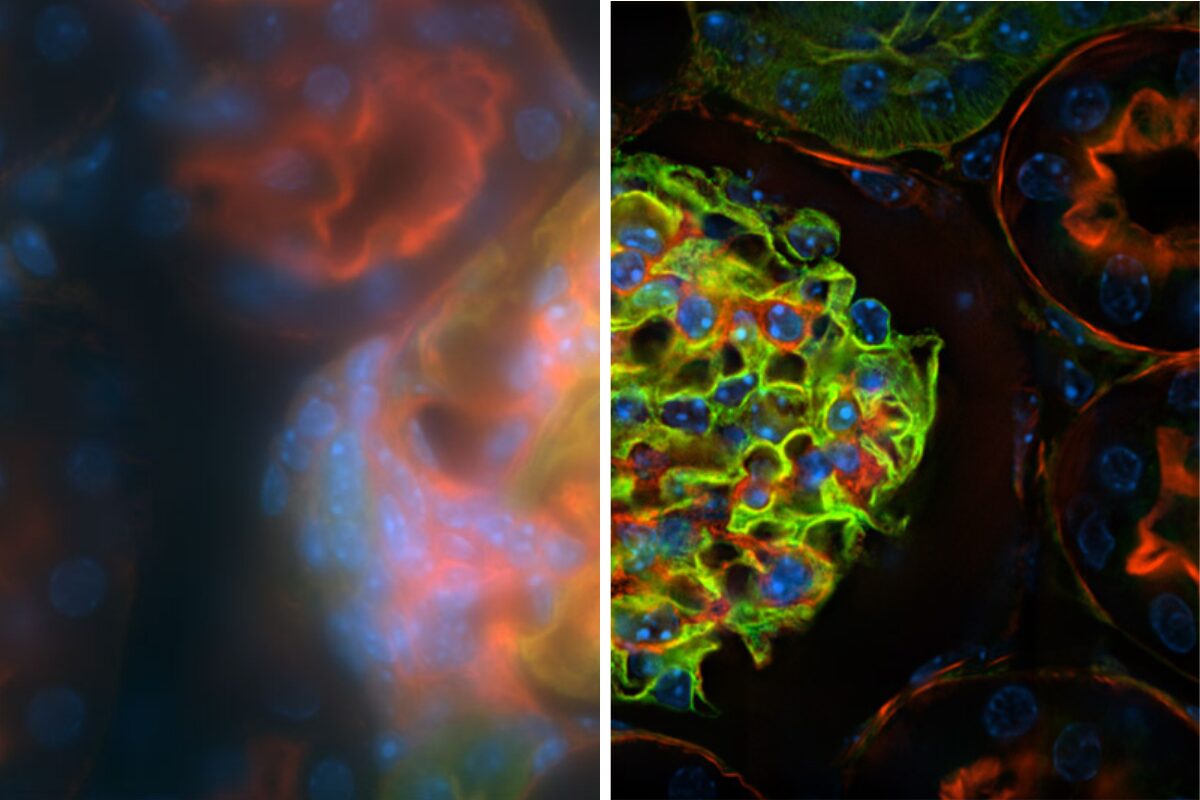 Add-Ons Unlock More Power​ - AutoQuant Deconvolution