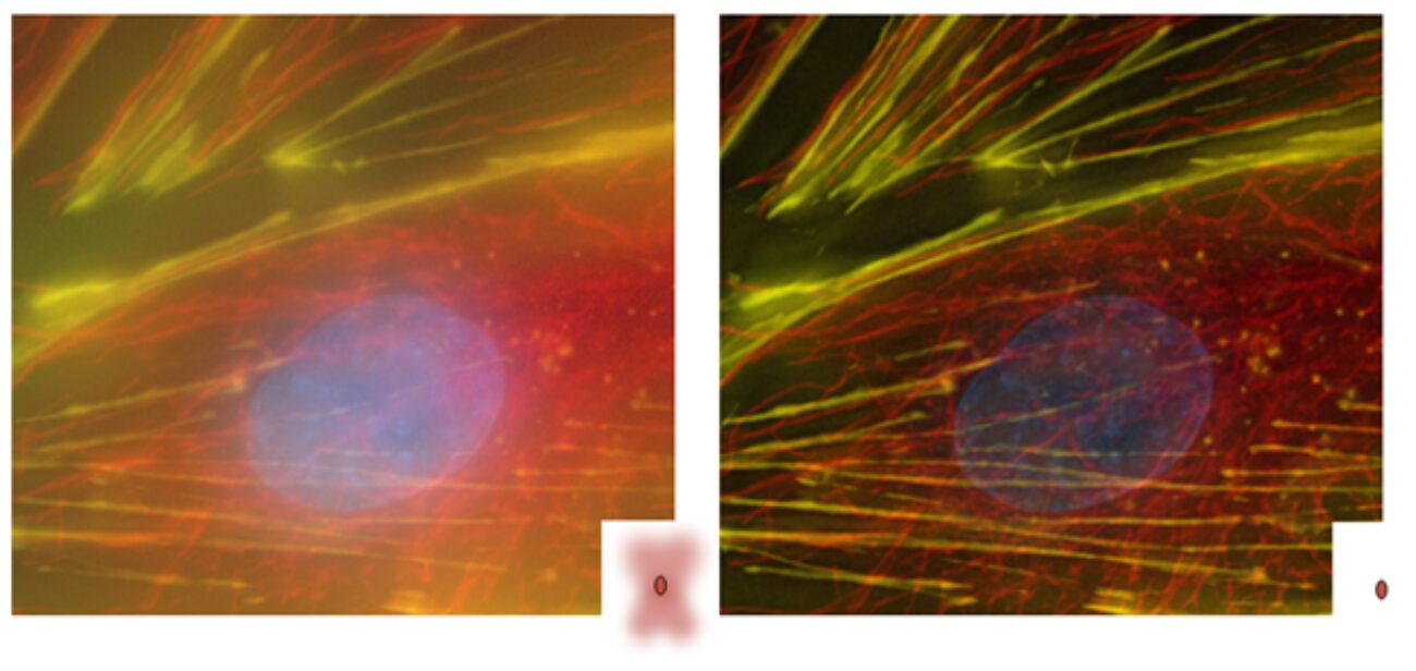 Best Practices to Improve Microscopy Image Sharpness with PSFs