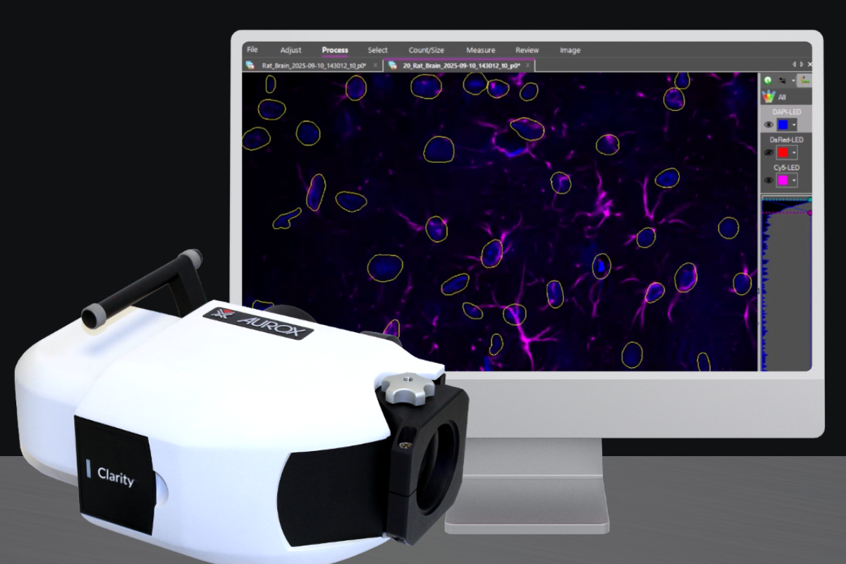 Streamline laser-free confocal microscopy with Aurox