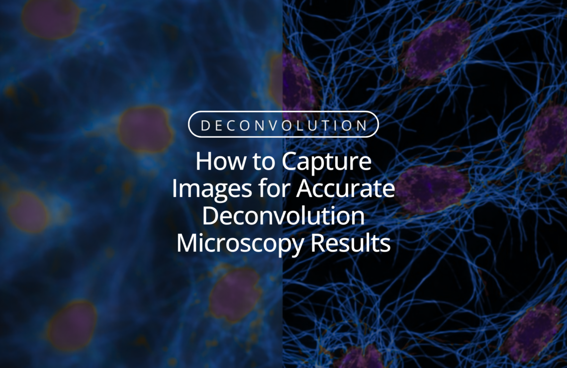 How to Capture Images for Accurate Deconvolution Microscopy Results