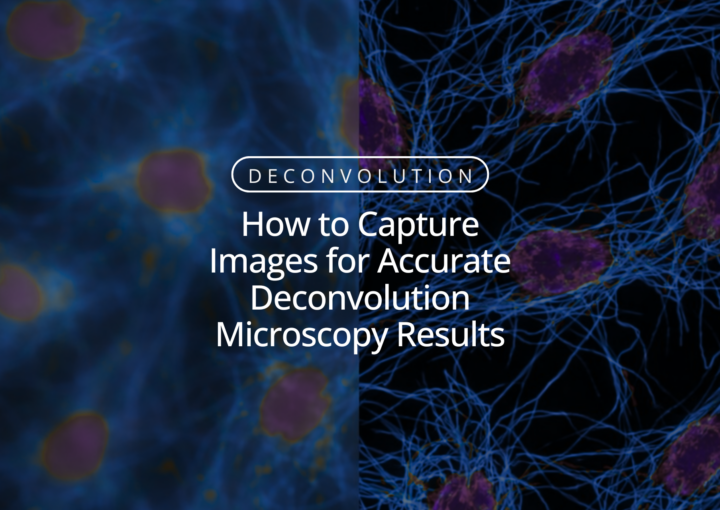 How to Capture Images for Accurate Deconvolution Microscopy Results How to Capture Images for Accurate Deconvolution Microscopy Results