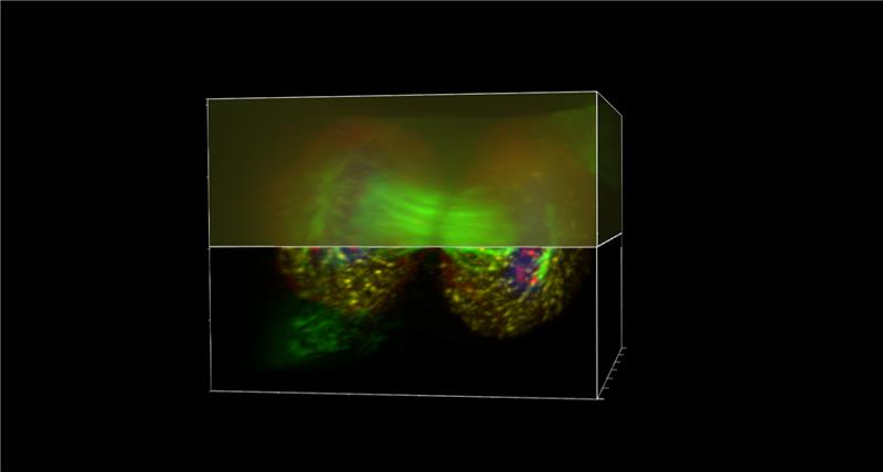 Acquiring additional planes above and below the specimen prevents edge artifacts