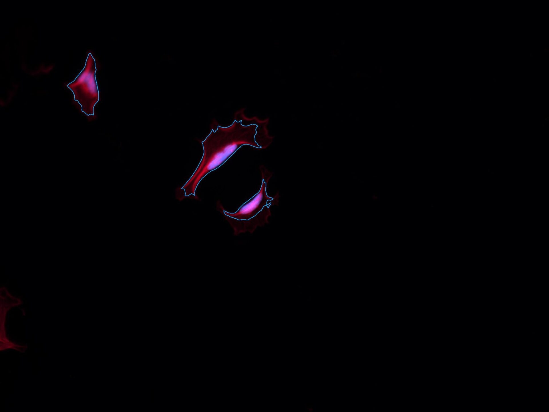 C11b-Cell_MorphologyAfter