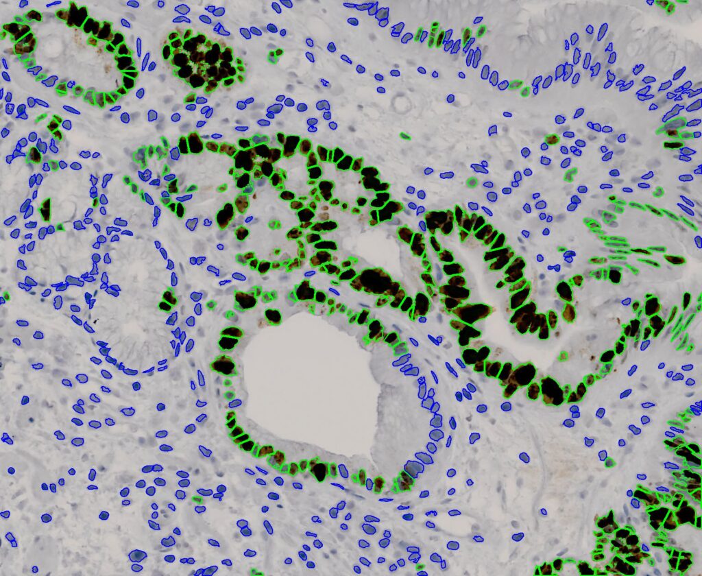Cell-Classification-After