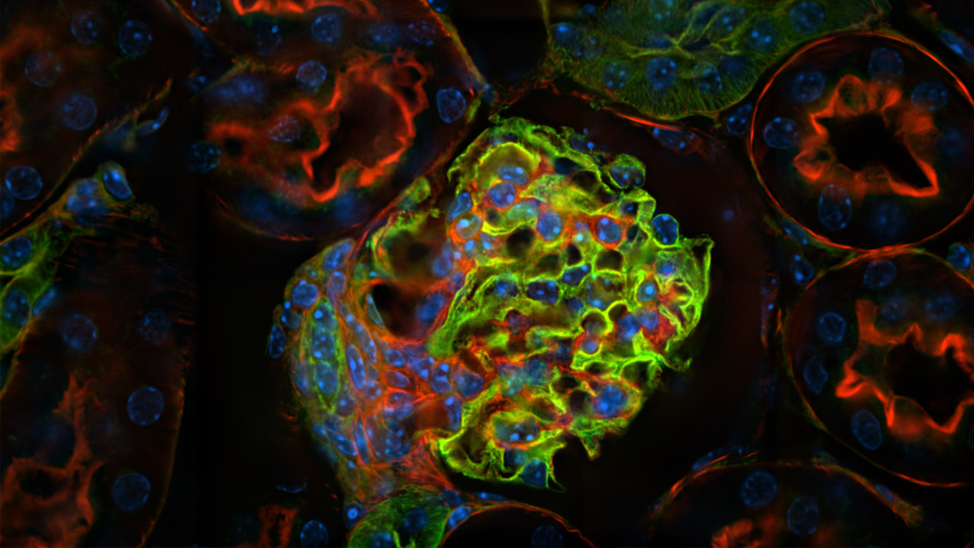 F01b-Kidney-After-crop