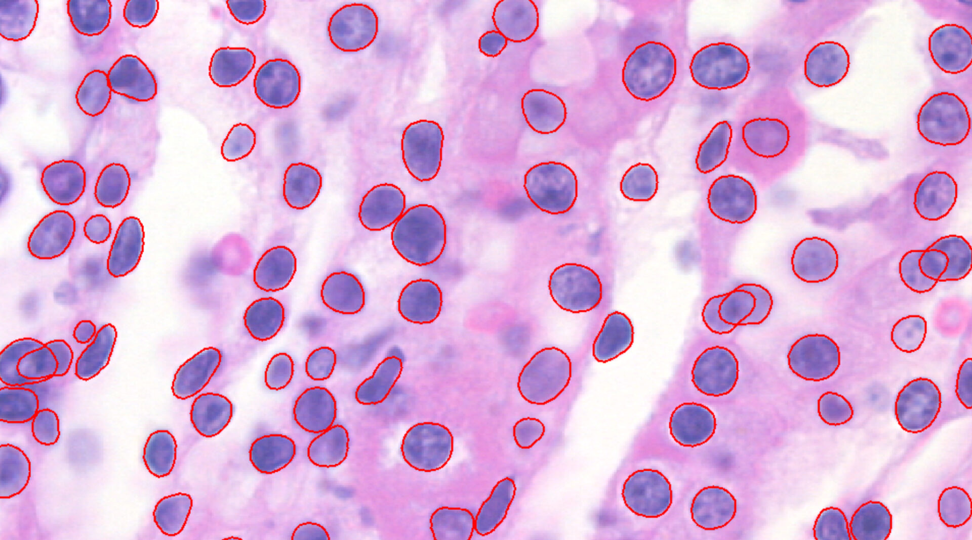Hematoxylin-stained-Nuclei-After