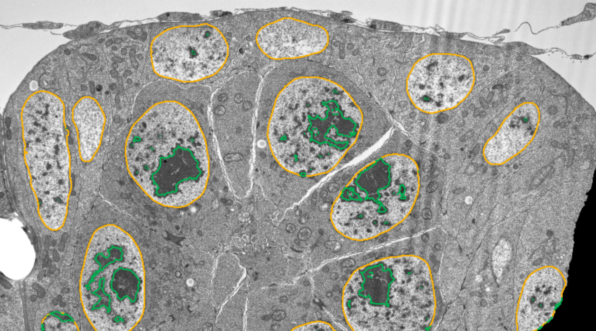 Nuclei-Chromatin-TEM-After